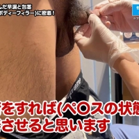 日本49岁大叔的包茎手术