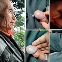 公园盘耄耋老人口+摸射叶子擦精记